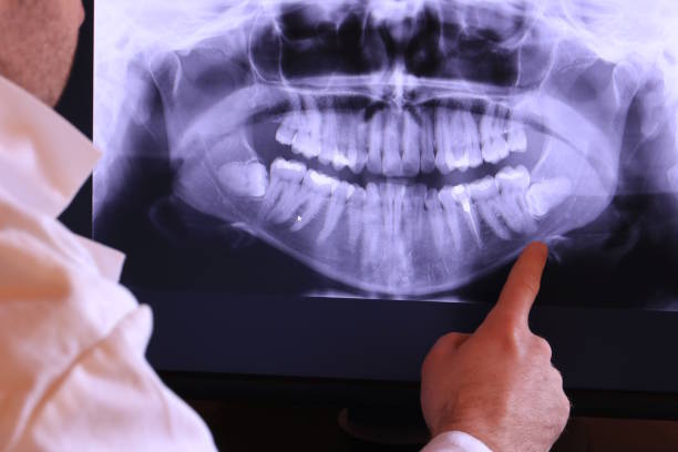 Best Emergency Tooth Extraction in Mableton, GA