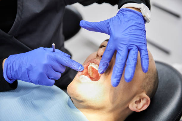 Best Emergency Dental Care for Broken or Chipped Teeth in Mableton, GA